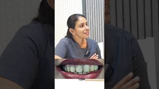 Dental veneers procedure for smile correction dentalexperience [upl. by Alfonse]