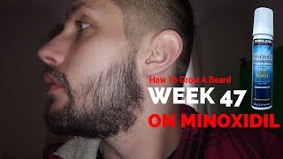 Minoxidil Beard  Week 47  Minoxidil 5 for Beard Growth  Facialfuzzfridays [upl. by Luella612]