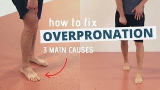 Pronated Feet and How to Fix 3 Different Causes of OVERPRONATION [upl. by Auj]