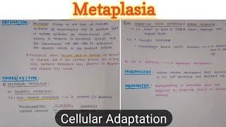 Cellular Adaptation 44  Metaplasia  General Pathology [upl. by Aliban800]