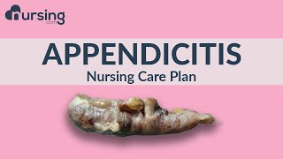 Helping someone with appendicitis  nursing interventions  Nursing Care Plans [upl. by Sanger]