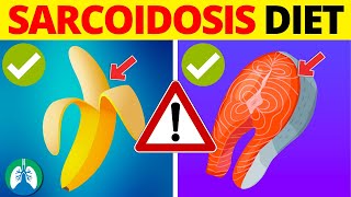 Sarcoidosis Diet  ONLY Eat These Foods and Which Ones to AVOID [upl. by Ard]