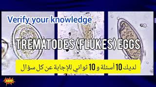 Trematodes identification training quiz أسئلة مختبرات طبية بيرسون فيو برومتريك أخصائي فني هيئة [upl. by Kcirtapnhoj]