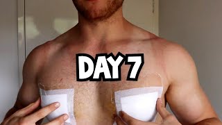 GYNO SURGERY RECOVERY DAY 7  TAKING THE COMPRESSION VEST OFF [upl. by Sirtimed]