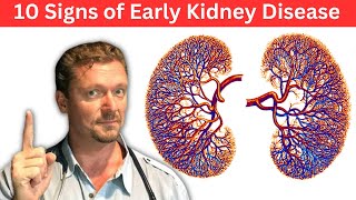 10 Signs of Early Kidney Disease amp Kidney Labs You Need [upl. by Voe252]