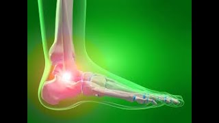 5 EXERCISES FOR ANKLE PAIN RELIEF [upl. by Reider563]