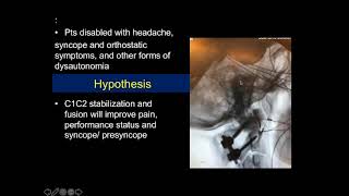 Atlantoaxial Rotary Instability Findings and Treatment Outcomes Research  Dr Fraser Henderson [upl. by Duaner998]