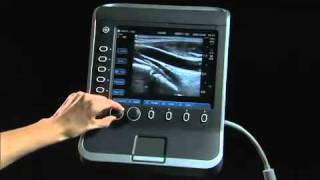 Sonosite S Series Product Training Part 1 System Overview [upl. by Haret]