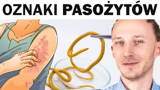 Objawy że pasożyty grasują w jelitach Jak je wygonić [upl. by Uchida]