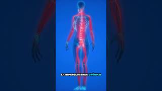 HIPERGLUCEMIA💀El PELIGROSO Impacto en Tu SALUD [upl. by Nodnarb]