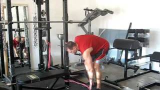 Glute Exercises Part III of III AbductorExternal Rotation Progressions [upl. by Haye]