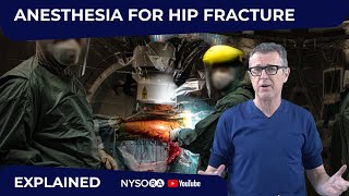 Anesthesia for Hip Fracture  Crash course with Dr Hadzic [upl. by Paluas133]