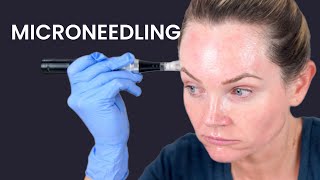 Microneedling NECK and CHEST with Dr Pen M8S Tightening my old skin at home [upl. by Ray]