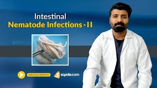 Intestinal Nematode Infections II  Medicine Lectures  Medical Education  VLearning [upl. by Notsreik842]