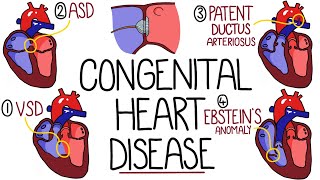 Congenital Heart Malformations Made Easy 8 Main Types [upl. by Adnerb]