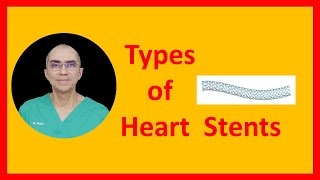 Types of Stents [upl. by Ahsinirt365]