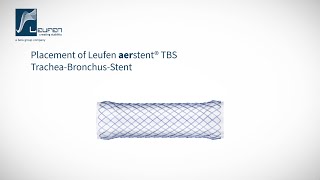 Placement of a Leufen aerstent® TBS [upl. by Wilton]