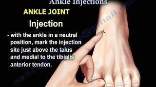 Common Foot And Ankle Injections  Everything You Need To Know  Dr Nabil Ebraheim [upl. by Syhr]