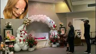 Adalia Rose last journey video Adalia Rose has passed away [upl. by Anirod]