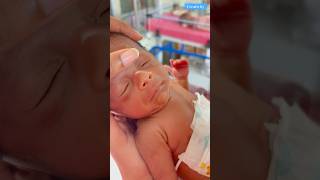 Newborn baby care video medical viralvideo [upl. by Echikson]