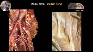 ANTERIOR ELBOW SONOANATOMY [upl. by Ennairol163]