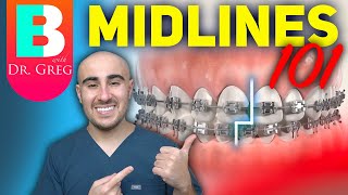 Braces Midlines 101  Elastics IPR Coils and more [upl. by Adlog275]