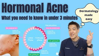 Hormonal acne explained in under 3 minutes  Dermatologist reviews [upl. by Carlin996]