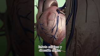 Infarto cardiaco y disección aórtica  Dr William Guerrero medicina shorts [upl. by Ganny218]