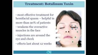 What is Hemifacial Spasm [upl. by Cyrus]