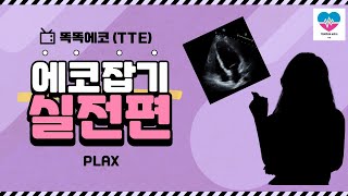 Parasternal long axis view 잡기 심장초음파 실전편 1탄 echocardiography 심장초음파 초음파 plax rdcs sonography [upl. by Tuinenga]