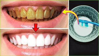 Whitening yellow teeth in just 3 minutes hydrogen peroxide with baking soda [upl. by Nowaj704]