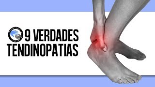 9 verdades sobre las tendinopatias o tendinitis que debes saber [upl. by Wunder]