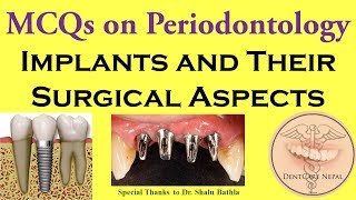 Basic Aspects of Dental Implants  MCQs in Periodontology  Periodontics Revisited [upl. by Quackenbush]