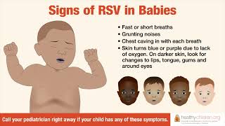 Signs amp Symptoms of RSV in Babies  AAP [upl. by Pauli696]