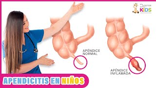 APENDICITIS EN NIÑOS síntomas  causas y tratamiento [upl. by Milas]