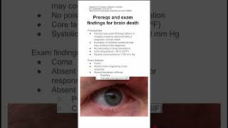 Prereqs and exam findings for brain death [upl. by Saddler]