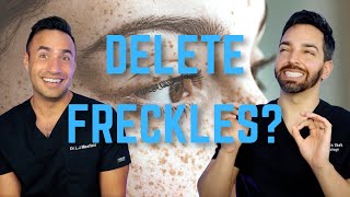 Freckles Does SPF and Retinol Fade Them [upl. by Bozuwa]