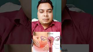 Treatment of fibroids in uterus at home fibroid trending [upl. by Eniamsaj]