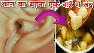 कान का बहना एक बार में जड़ से खत्म ear discharge Otorrhoea [upl. by Berty]