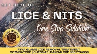 How to remove Lice from Hairhow to remove Lice permanentlyhow to prevent from LiceLice removal [upl. by Vadim]