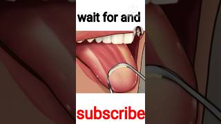 ASMR Satisfying Tonsil Stone Removal Animation  The cause of Bad Breathtrendingshortsshorttren [upl. by Aroved654]