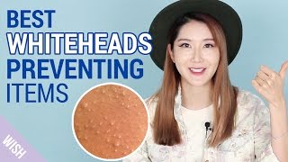 What causes Whiteheads  How to prevent Whiteheads  Wishtrend [upl. by Alinoel]