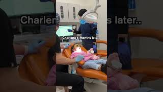 Highly observant child remembers instructions TOO well 😂 Pediatric Dentist [upl. by Norita]