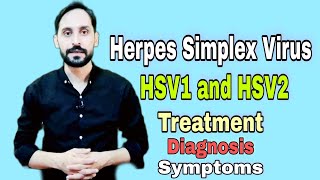 Herpes Simplex Virus HSV  Types  Diagnosis  Symptoms  Treatment and Prevention [upl. by Ert]