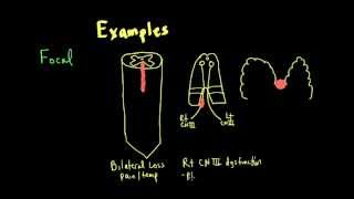 Schneid Guide to Neurological Lesion Localization [upl. by Rubio]