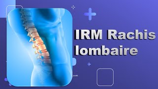 IRM du Rachis lombaire Bonne Pratique [upl. by Nye229]