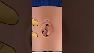 Satisfying navel stone removal animation animation asmr shorts youtubeshorts [upl. by Aseeram]