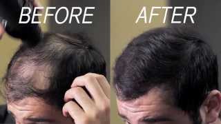 Hair Fibers Self Applied by Male  Eclipse Instant Hair Filler [upl. by Accever]