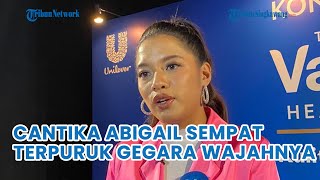 Cantika Abigail Sempat Terpuruk Gegara Wajahya Gatal Parah Akibat Autoimun Psoriasis [upl. by Nibla625]