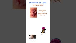 HERPES ZOSTER PATHOPHYSIOLOGY [upl. by Dustman750]